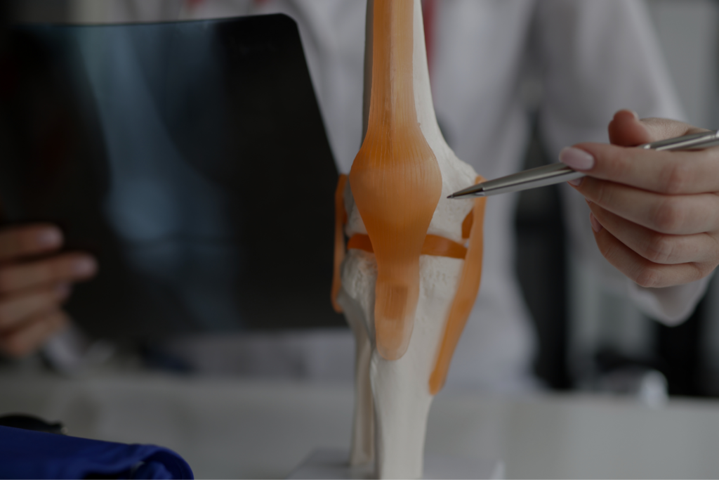 Centro Médico y Dental Kinefisio Tratamiento de lesiones de rodilla: opciones y recomendaciones