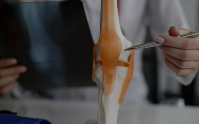 Tratamiento de lesiones de rodilla: opciones y recomendaciones