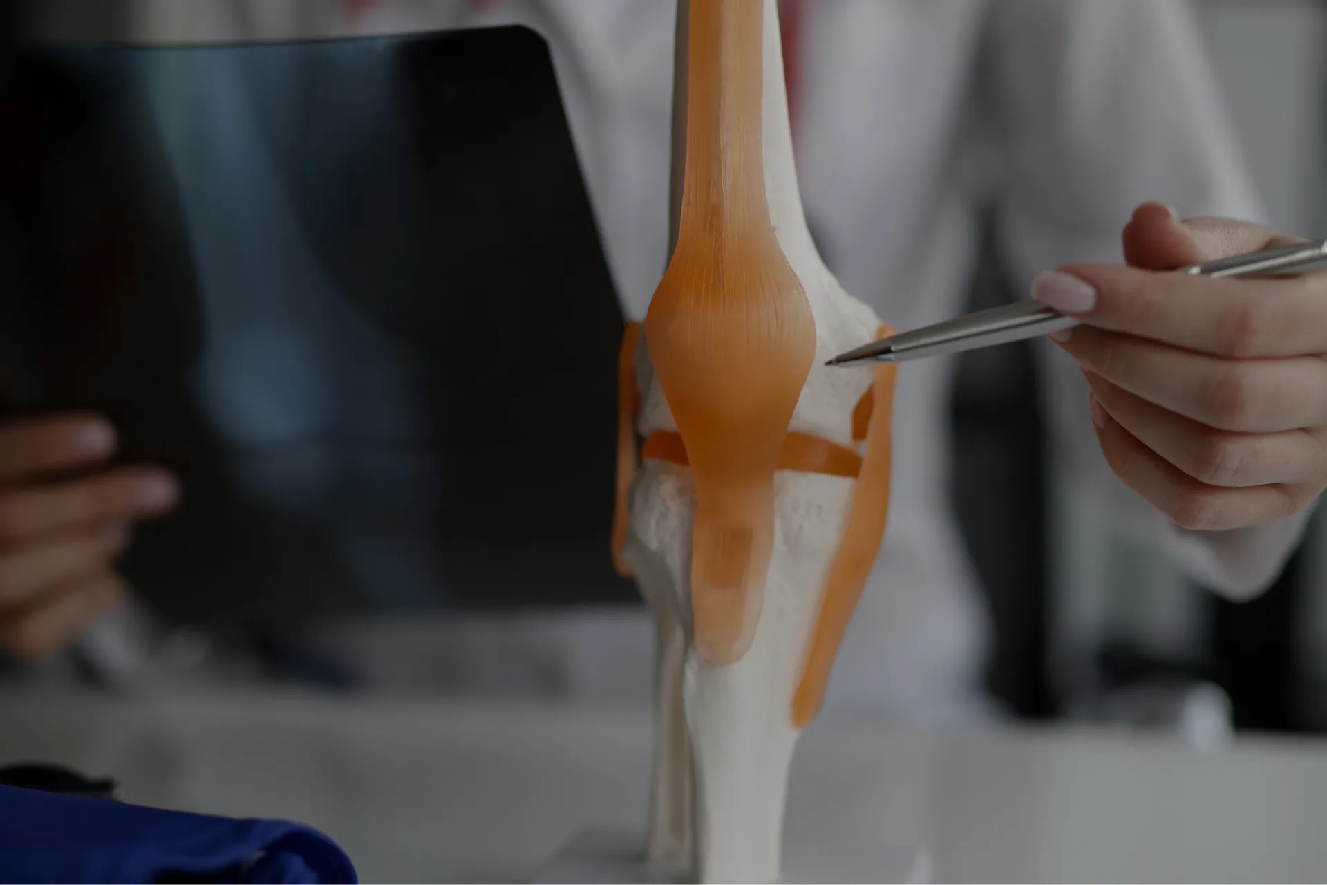 Tratamiento de lesiones de rodilla