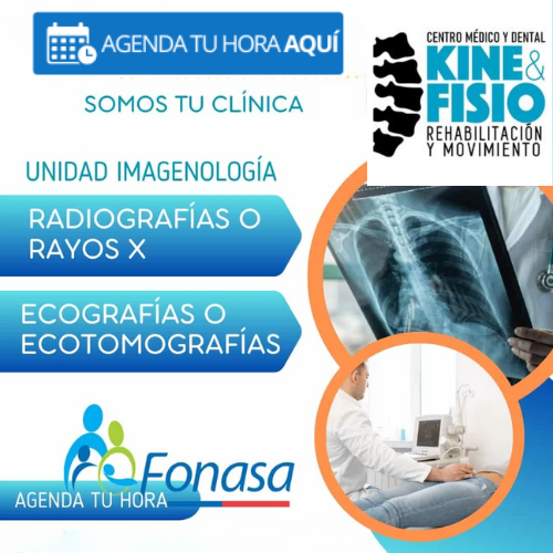 Centro Médico y Dental Kinefisio Servicios de Radiografía Integral en Kinefisio - La Serena