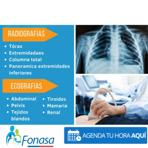 radiografías